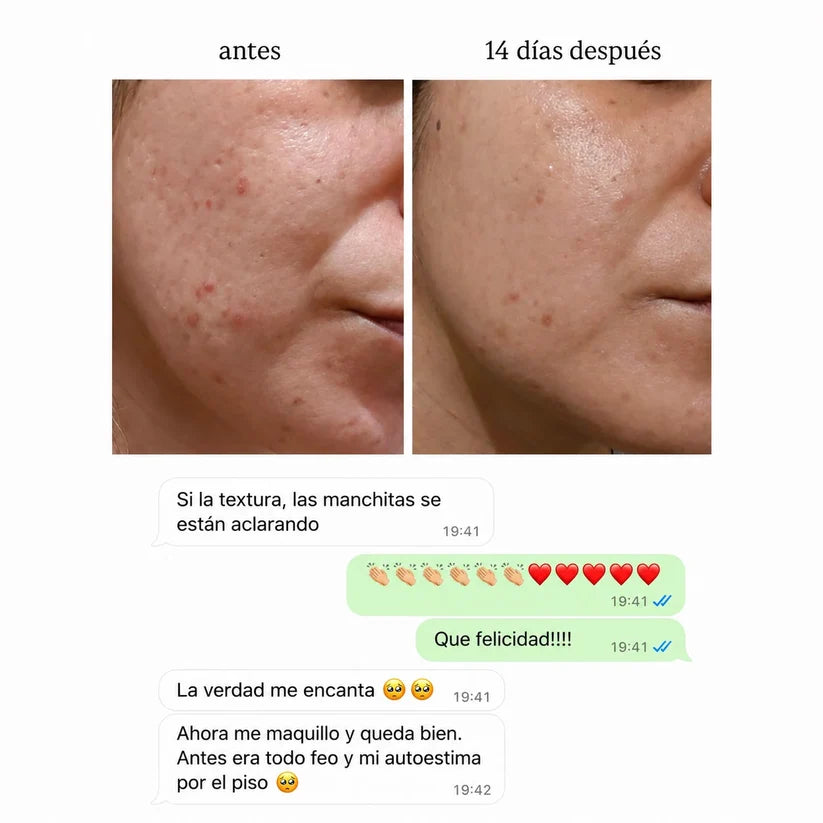 CLEAR ADVANCE® | Suplemento Anti Acné